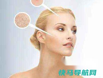 脸上爆皮怎么回事 第3张